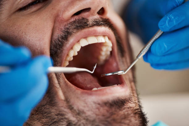 Best Emergency Dental Care for Broken or Chipped Teeth in Auburn, NE