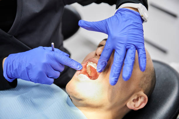 Best Emergency Tooth Extraction in Auburn, NE